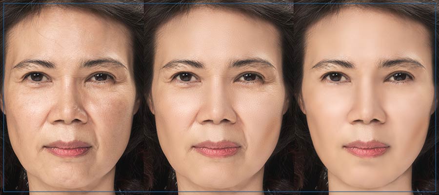 Aging Skin Treatments Near Me in Lake Zurich, IL