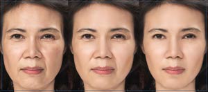 Aging Skin Treatments Specialist Near Me in Lake Zurich IL