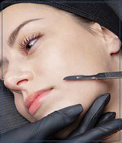 Dermaplaning Treatment at Cara Mia Med Spa in Lake Zurich, IL