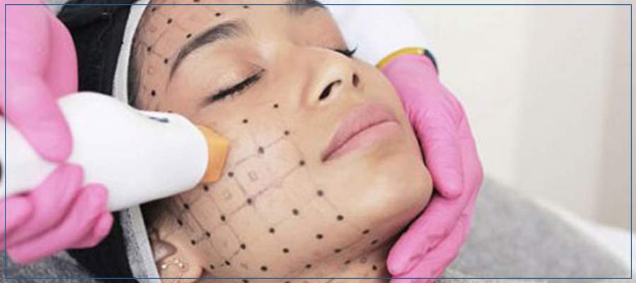 Thermage Treatment Specialist Near Me in Lake Zurich, IL Thermage Treatment Specialist Near Me in Lake Zurich, IL