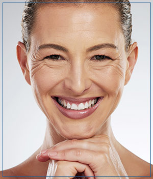 Thermage Treatment at Cara Mia Med Spa in Lake Zurich, IL