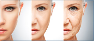 Thermage Treatments Cost Near Me in Lake Zurich IL