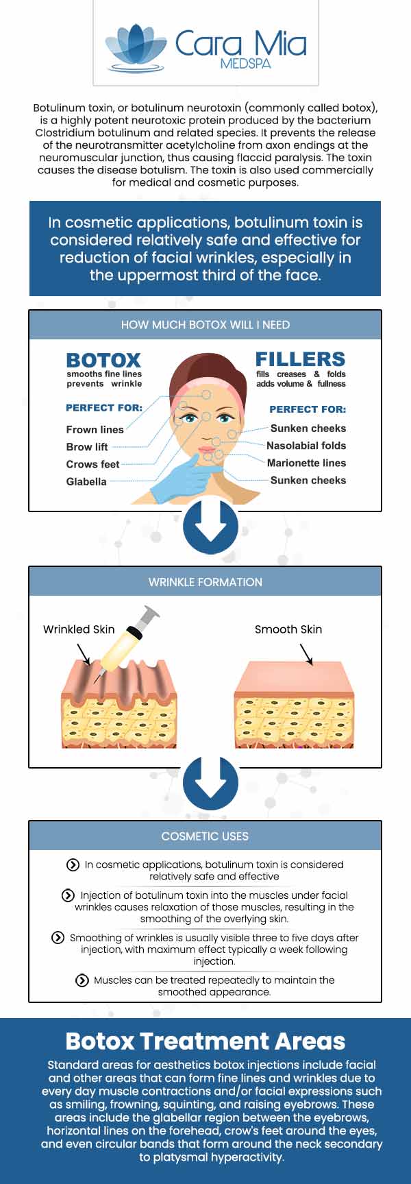 Botox injections inhibit specific chemical impulses from nerve cells which lead muscles to contract. The most frequent use for these injections is for relaxing the facial muscles that generate frown lines and other wrinkles. Our team of experts at Cara Mia Med Spa Offers Botox Injections for frown lines and wrinkles near Wauconda, IL. For more information contact us or book an appointment online. We are conveniently located at 303 North Rand Rd, Lake Zurich, IL 60047.