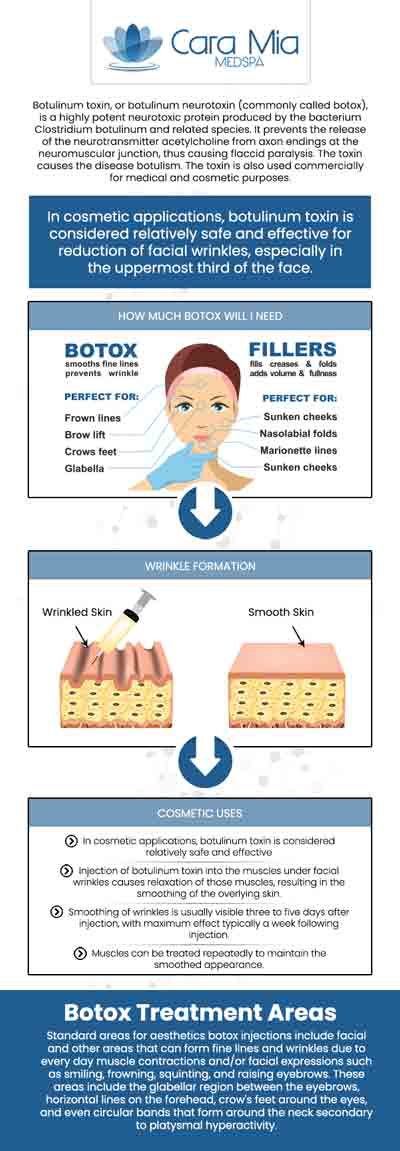 Botox injections inhibit specific chemical impulses from nerve cells which lead muscles to contract. The most frequent use for these injections is for relaxing the facial muscles that generate frown lines and other wrinkles. Our team of experts at Cara Mia Med Spa Offers Botox Injections for frown lines and wrinkles near Wauconda, IL. For more information contact us or book an appointment online. We are conveniently located at 303 North Rand Rd, Lake Zurich, IL 60047.