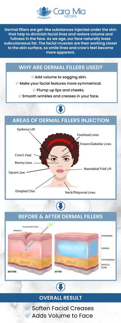 Individuals choose dermal fillers to improve their facial characteristics or achieve a younger-looking look. Using injectable dermal fillers, our specialists can help patients reduce the visible effects of aging, enhance facial volume, and restore a more youthful appearance. For more information, contact us or schedule an appointment online. We are conveniently located at 303 North Rand Rd, Lake Zurich, IL 60047.