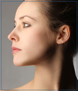 Exceed Microneedling at Cara Mia Med Spa in Lake Zurich, IL
