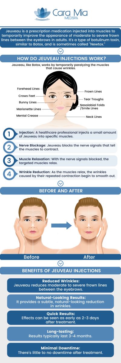 Jeuveau is an FDA-approved injectable botulinum toxin treatment that temporarily reduces fine lines and wrinkles. It inhibits nerve transmission, causing the muscles to relax. Jeuveau is primarily used to eliminate crow's feet between the eyebrows and it may be appropriate for people with crow's feet, frown lines, broad jaws, and sagging brows. Jeuveau can help improve the appearance of many facial areas. If you want to boost your looks, you have come to the right clinic! At Cara Mia Medspa our specialists offer Jeuveau. For more information, contact us or book an appointment online. We are located at 303 N Rand Rd, Lake Zurich, IL 60047. Jeuveau is an FDA-approved injectable botulinum toxin treatment that temporarily reduces fine lines and wrinkles. It inhibits nerve transmission, causing the muscles to relax. Jeuveau is primarily used to eliminate crow's feet between the eyebrows and it may be appropriate for people with crow's feet, frown lines, broad jaws, and sagging brows. Jeuveau can help improve the appearance of many facial areas. If you want to boost your looks, you have come to the right clinic! At Cara Mia Medspa our specialists offer Jeuveau. For more information, contact us or book an appointment online. We are located at 303 N Rand Rd, Lake Zurich, IL 60047.
