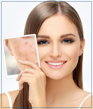 Scars Treatment at Cara Mia Med Spa in Lake Zurich, IL