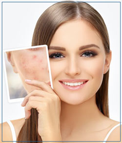 Scars Treatment at Cara Mia Med Spa in Lake Zurich, IL